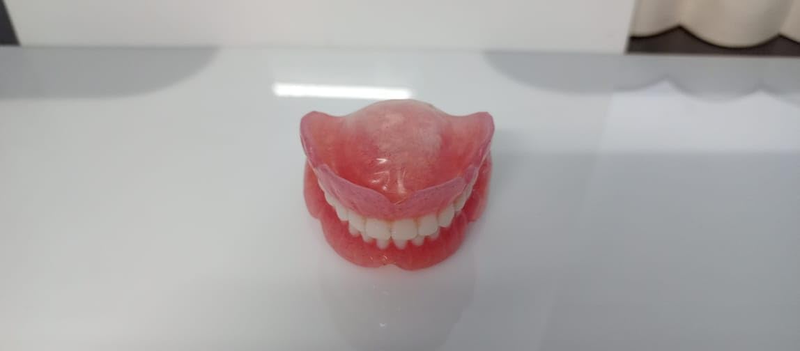 Full Set Upper & Lower Denture B324