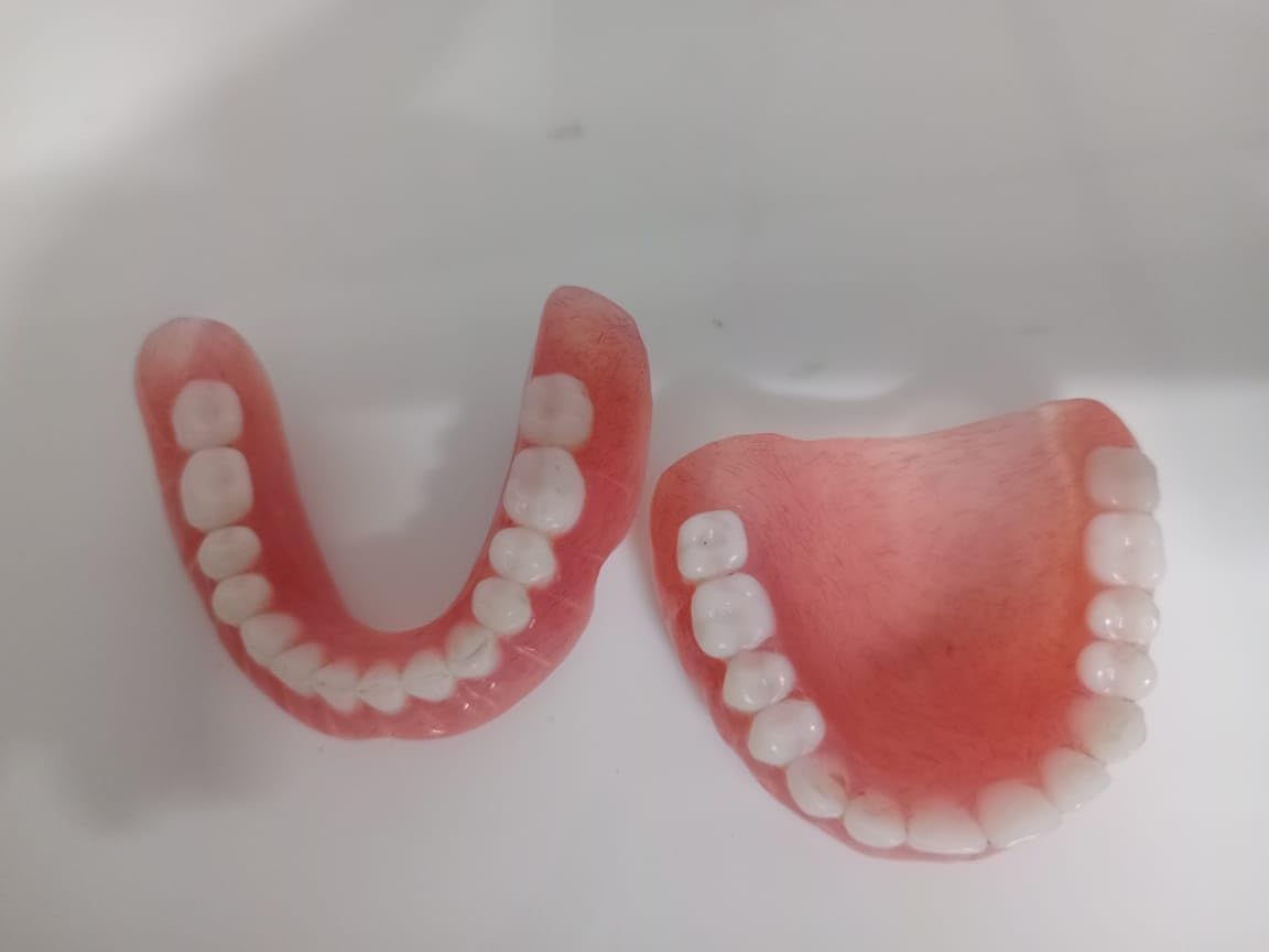 Full Set Upper & Lower Denture B324