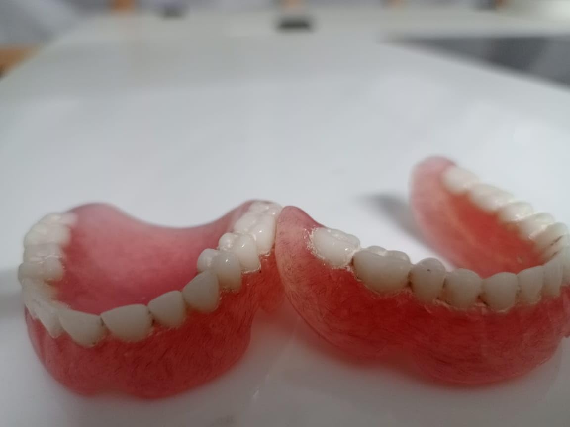 Full Set Upper & Lower Denture B324