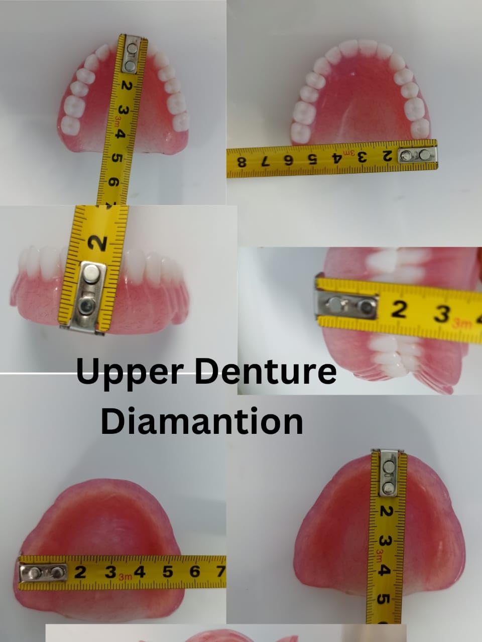 Full Set Upper & Lower Denture B324