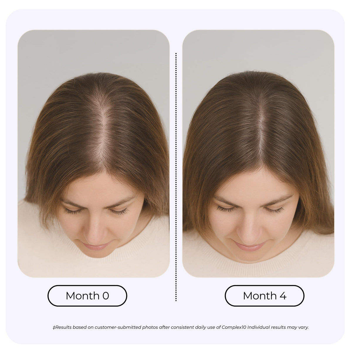 Biotin Collagen Hair Support Supplement 30 Capsules S457072